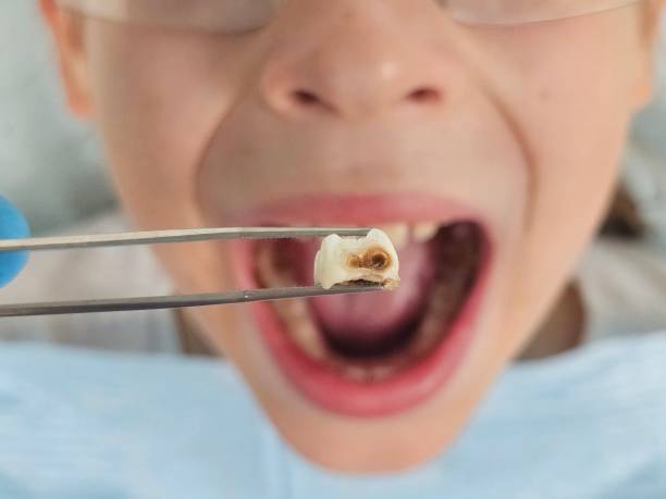 Best Cosmetic Emergency Dentistry in Exander City, AL