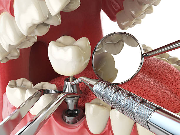 Best Emergency Gum Treatment in Exander City, AL
