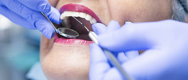 Best Same-Day Emergency Dental Services in Exander City, AL
